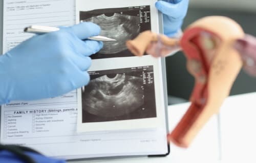 생리량이-줄어드는-이유