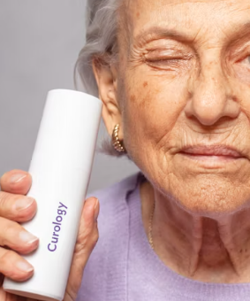 검버섯 없애는 방법 민간요법 얼굴 손등