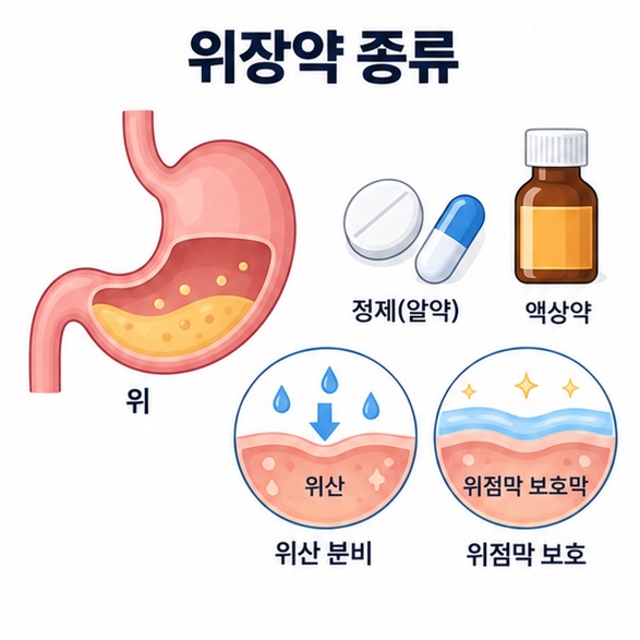 위장약 종류 대표 키워드와 위 모양 아이콘, 약 정제를 함께 배치한 교육용 인포그래픽