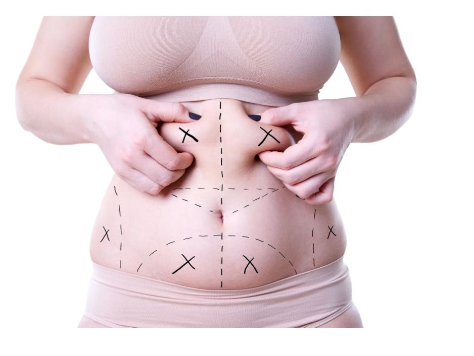 총 콜레스테롤 이란