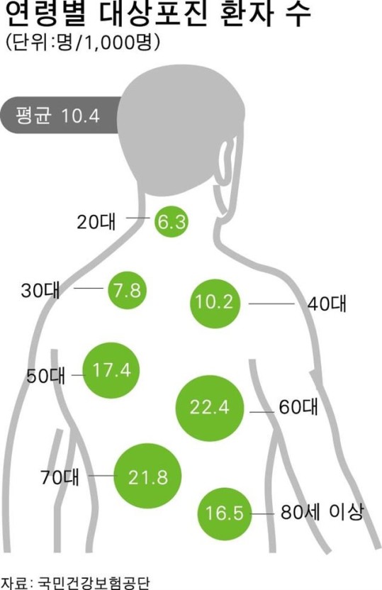 대상포진 연령별 분포