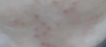 피지 얼룩 식초 분무 후 주방타월로 눌러 빼는법_10