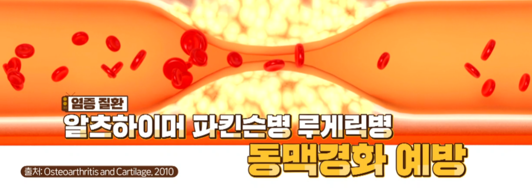 콘드로이친