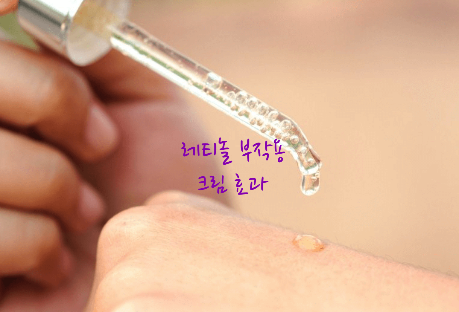 레티놀 부작용