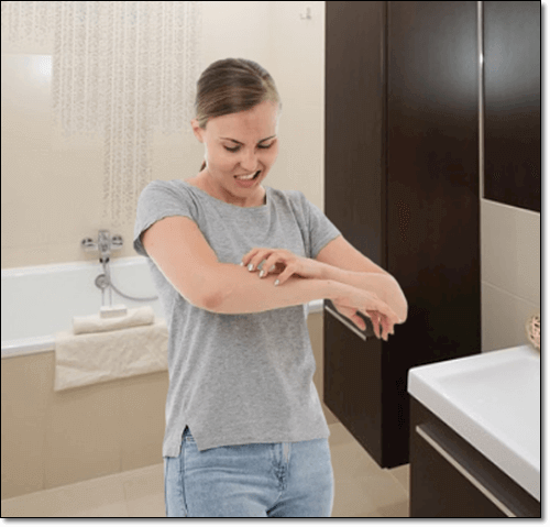 아토피 피부염 여성