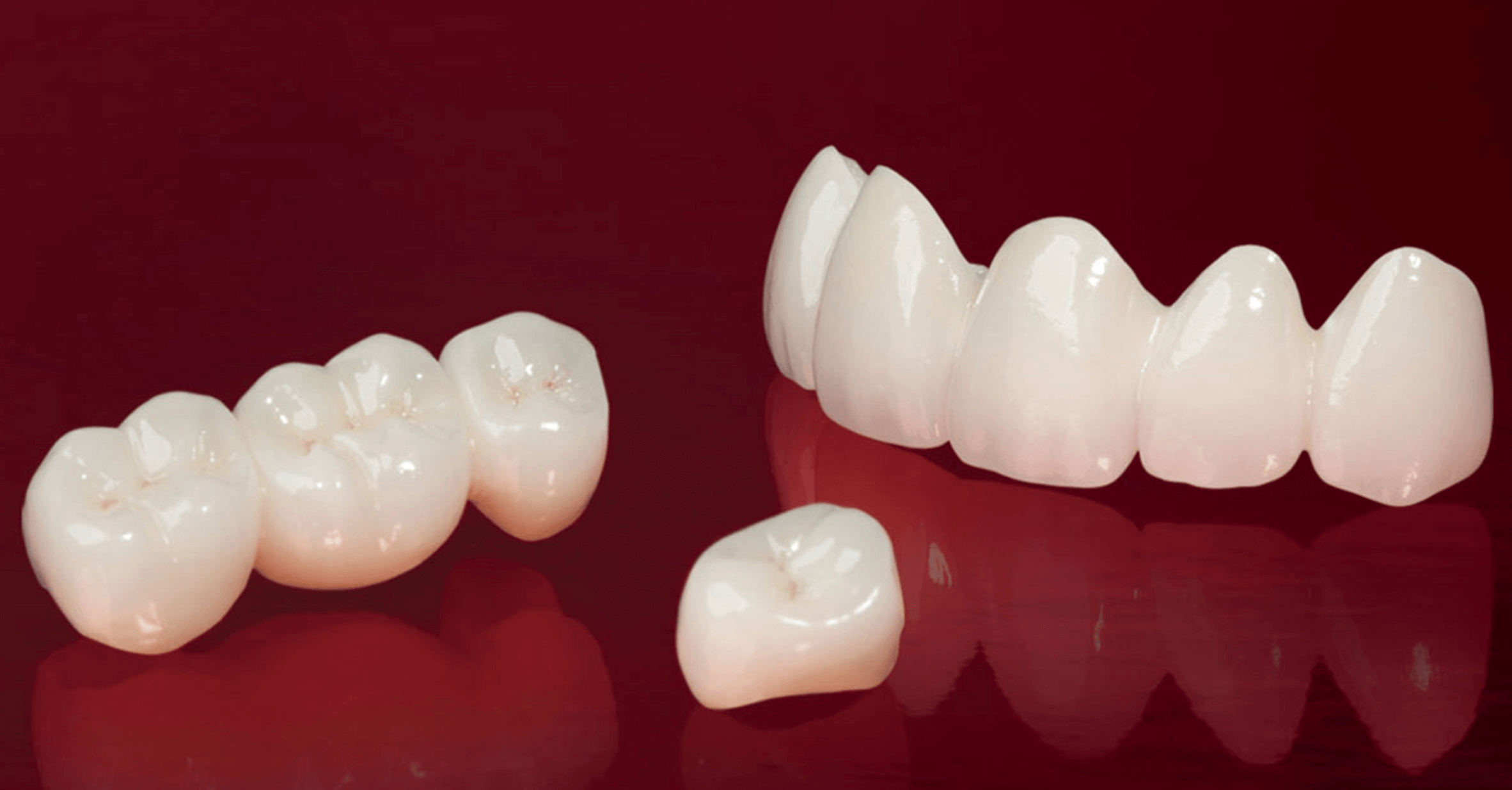 지르코니아 크라운