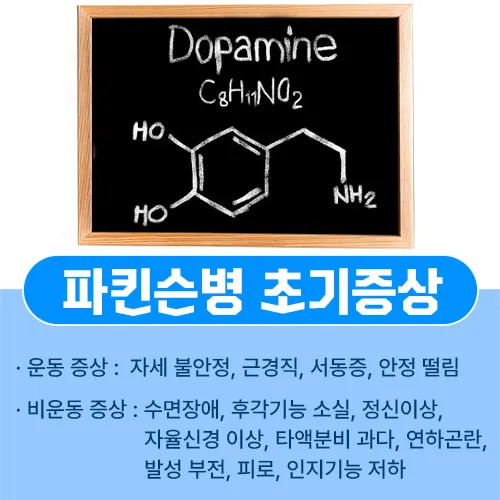 파킨슨병 초기증상