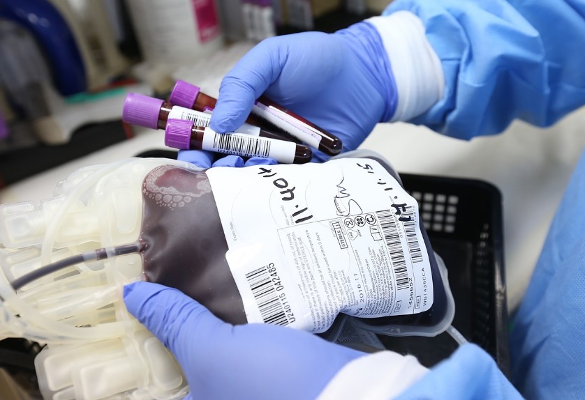 탈모 병원 치료