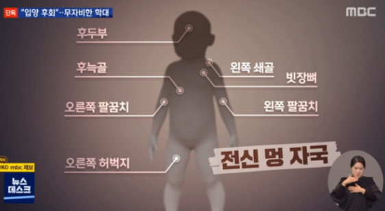 정인이 사망원인