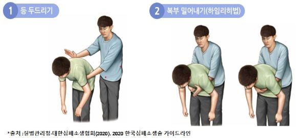 하임리히법