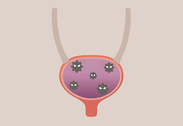 해부학적인-여성-방광의-모습