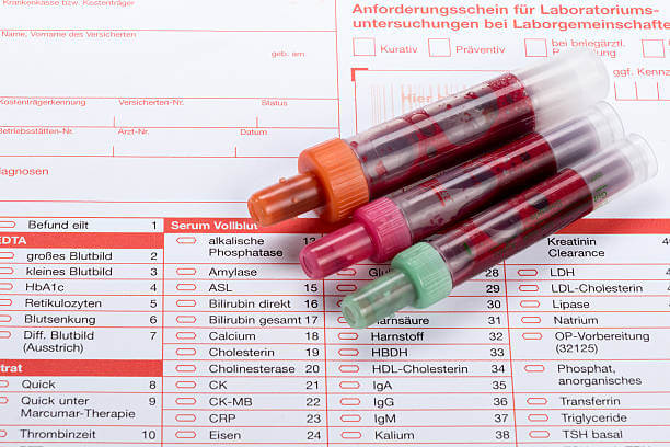 감마지티피 수치, alt, ast, 감마 GTP를 들어 보셨나요? 간 수치를 감사할 때 확인해 볼 수 있는 수치입니다. 각각 어떤 수치를 확인할 수 있는 지와 정상수치는 기준을 알아봤습니다. 또한 간이 안 좋을 때 나타나는 증상들은 어떤 것들이 있을까요?