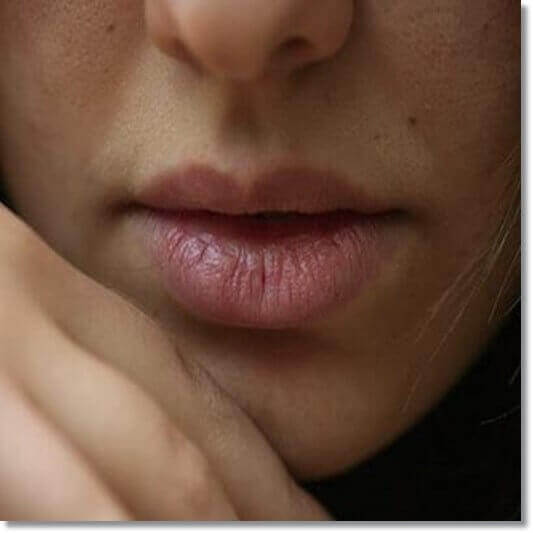 혓바늘 없애는 법, 원인 및 증상과 알보칠