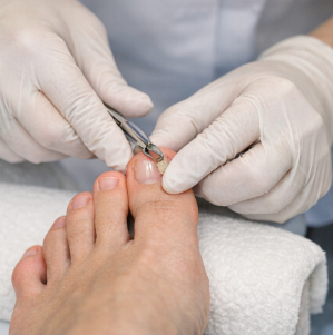 내성발톱 안생기는법(교정 및 치료 방법) 완벽 가이드 2026