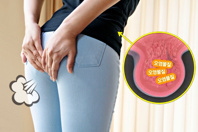 장에 독소가 쌓이면, 장독소배출방법 장독소자가진단 방귀, 장게실염 대장암, 건강 팁줌 매일꿀정보