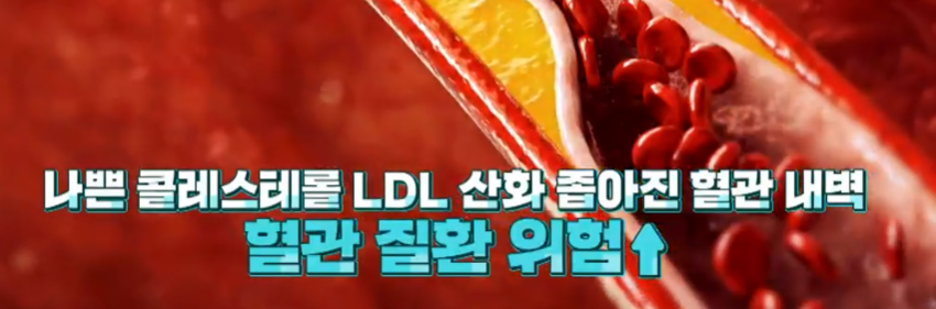 콘드로이친