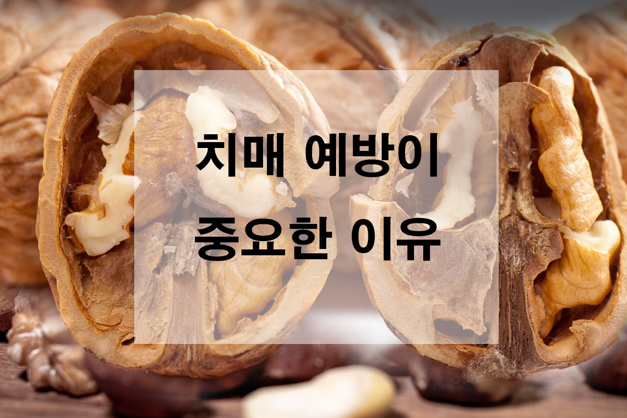 치매 예방이 중요한 이유 