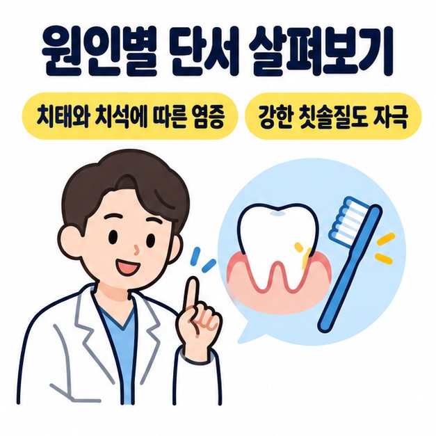 치과 의료진과 치아 및 칫솔 아이콘을 통해 치태와 치석에 따른 염증과 강한 칫솔질의 자극을 설명한 그림