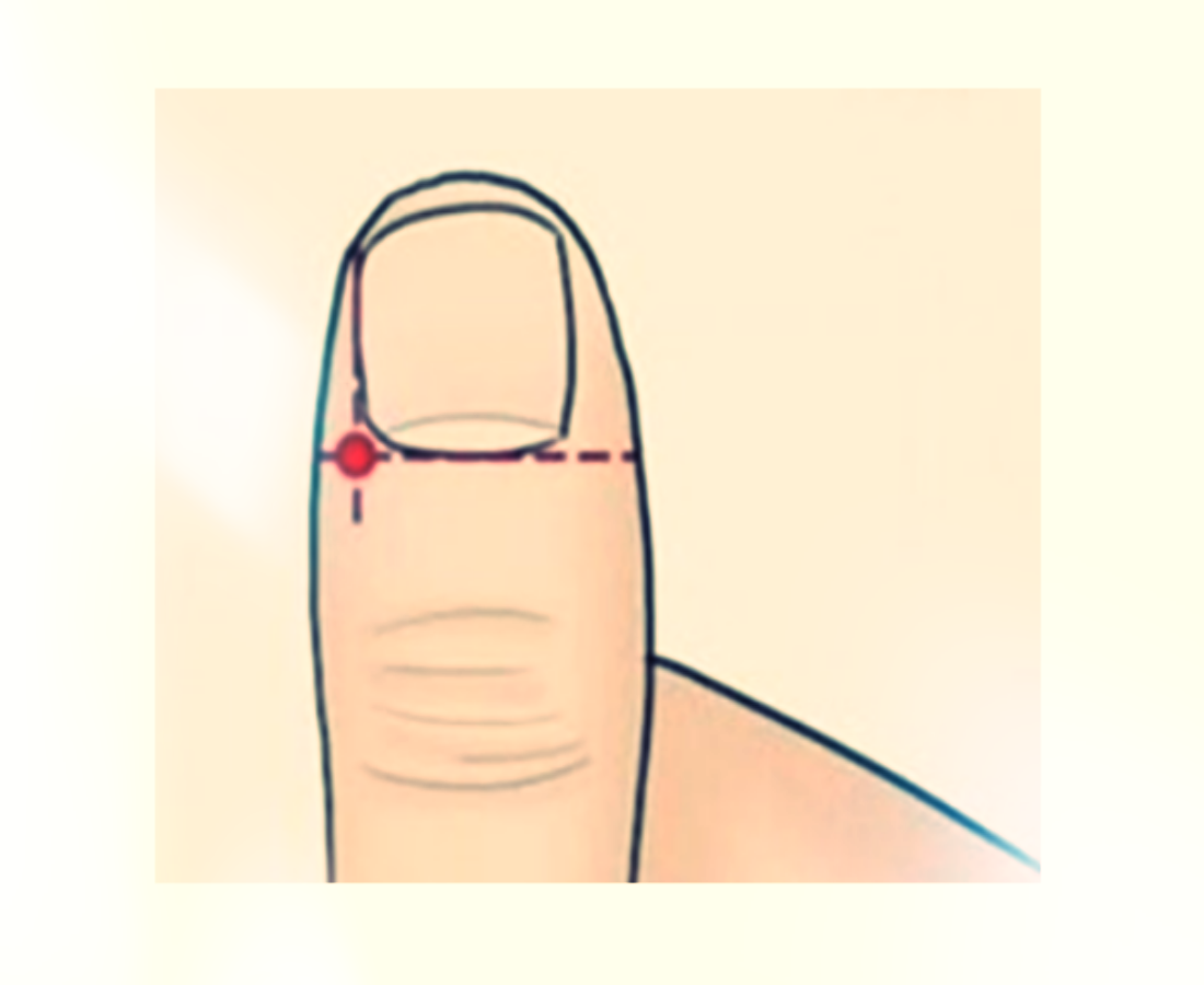 체했을때-손따는법