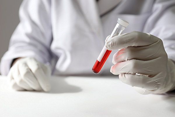 Total Protein 수치