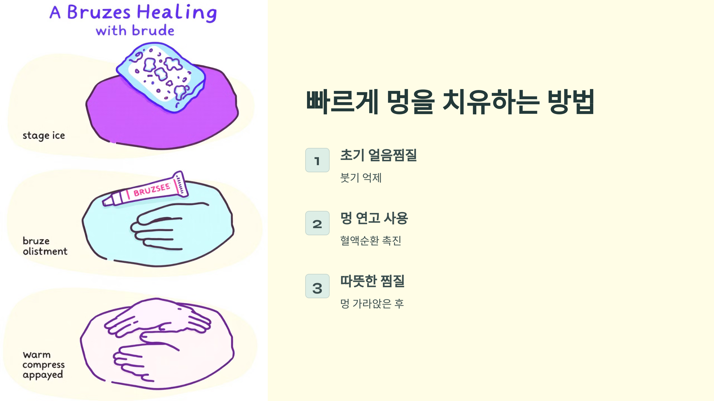 멍든에 바르는 약 연고