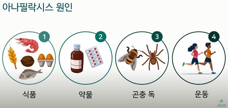 아나필락시스