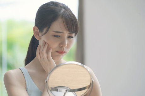 피부로 고민하는 여성.