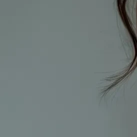 쌍꺼풀 수술 이미지