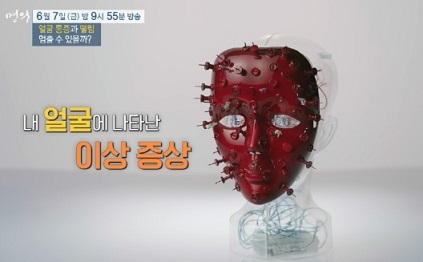 얼굴의이상증상