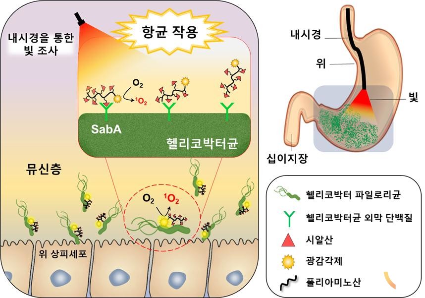 헬리코박터균의 진단 방법