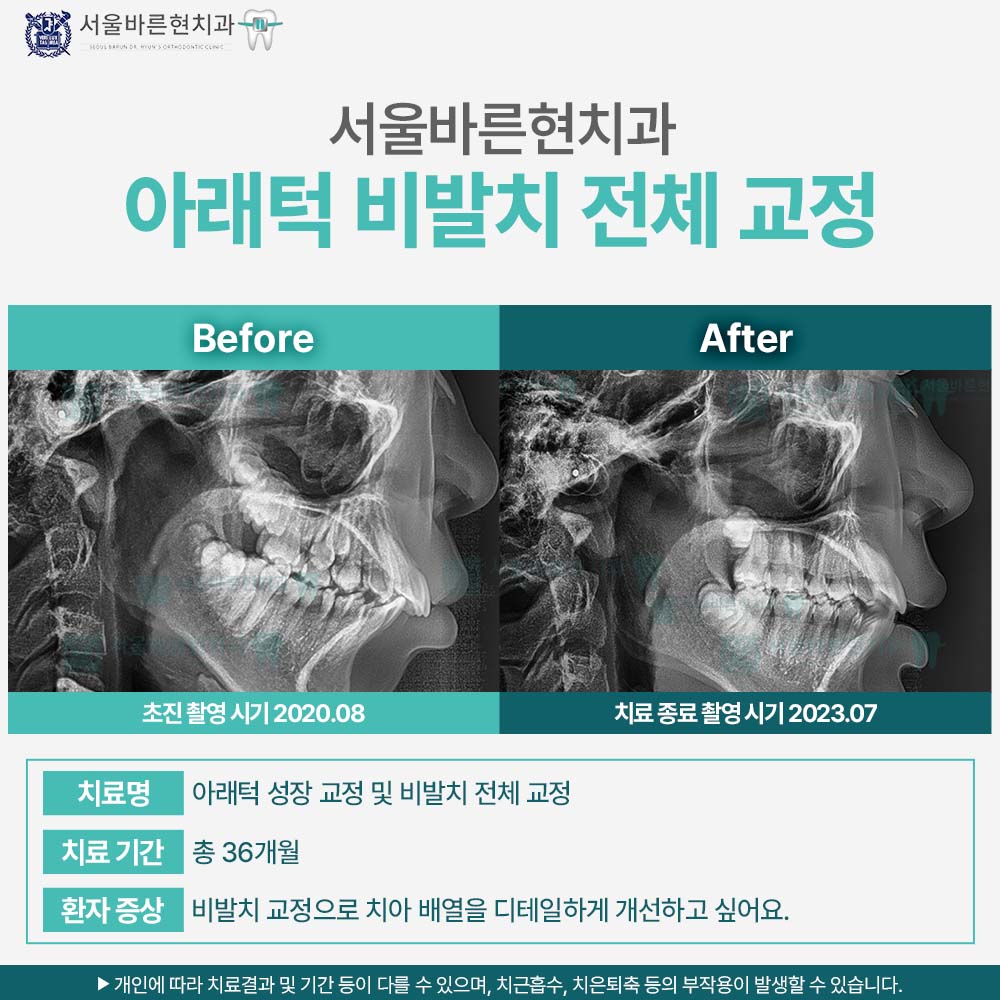 마린시티교정치과