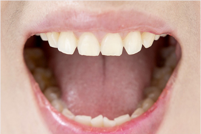 치아 건강에 좋은 음식도 있어요? 처음 듣네~