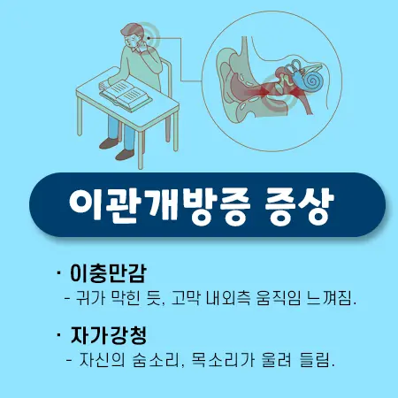 아이유 이관개방증