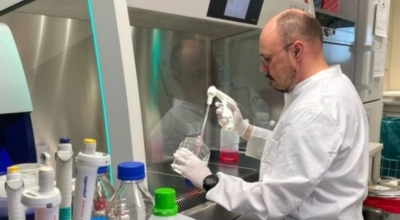 원숭이두창 이미지