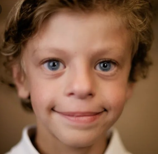 윌리엄스 증후군