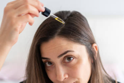 지루성 피부염 완치 원인 샴푸 연고 종류 지루성 피부염 탈모