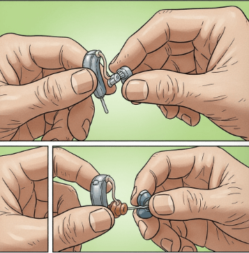 귓속형 보청기 가격 총정리13