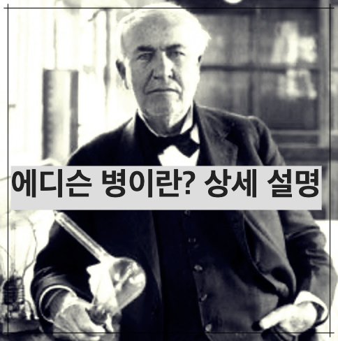 에디슨 병이란? 상세 설명