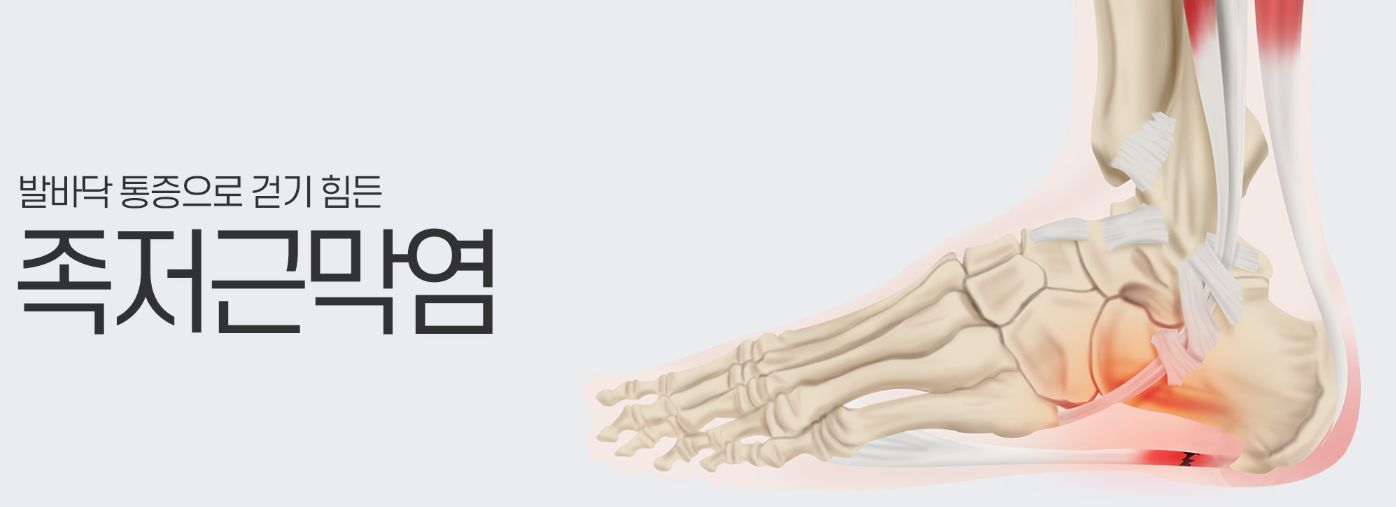 족저근막염의 증상