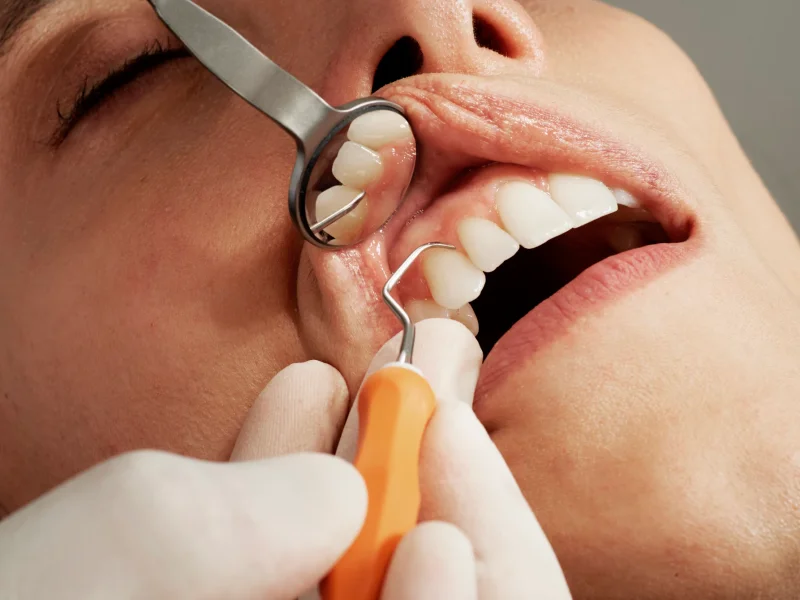 치간칫솔 사용법