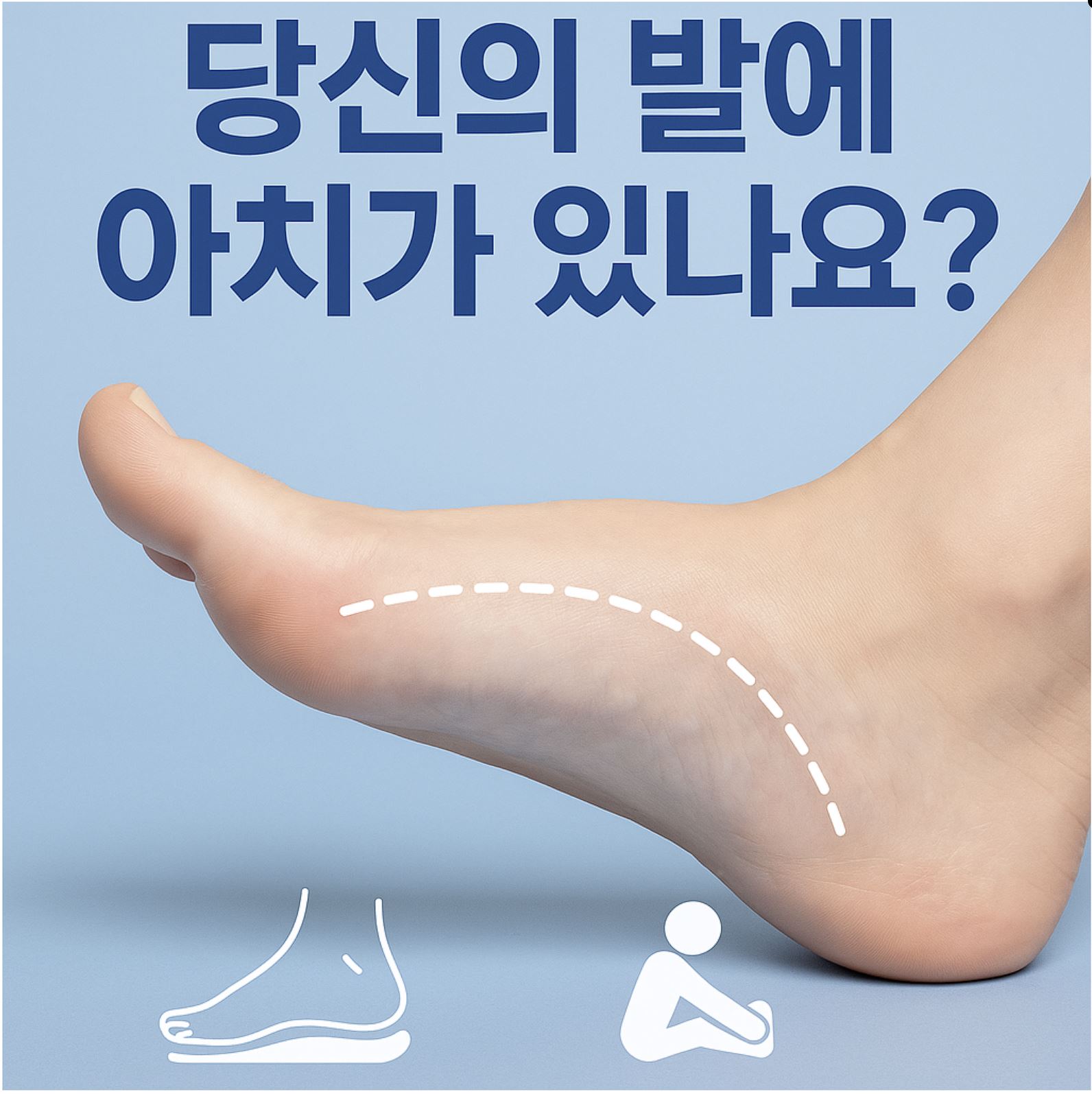 아치형 발바닥 썸네일
