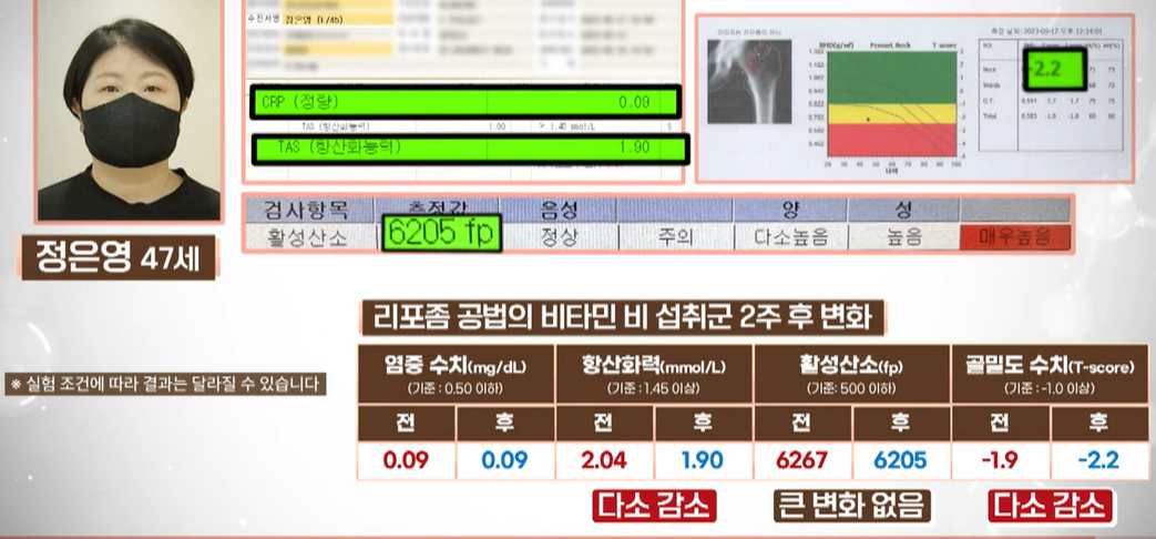 리포좀 비타민C 효능