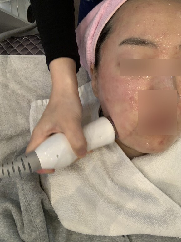 크라이오셀 후기