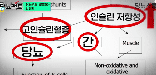 당뇨와 간: 췌장만큼 중요한 이유