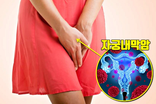 폐경후 질출혈,놓치기 쉬운 암 증상 7가지,자궁암 증상 원인,건강,팁줌 매일꿀정보