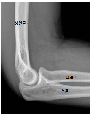 팔꿈치 관절의 구조 사진출처 대한 정형외과 학회 홈페이지