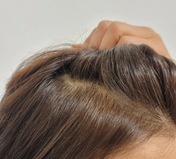 그래비티 탈모 샴푸 내돈내산 효과