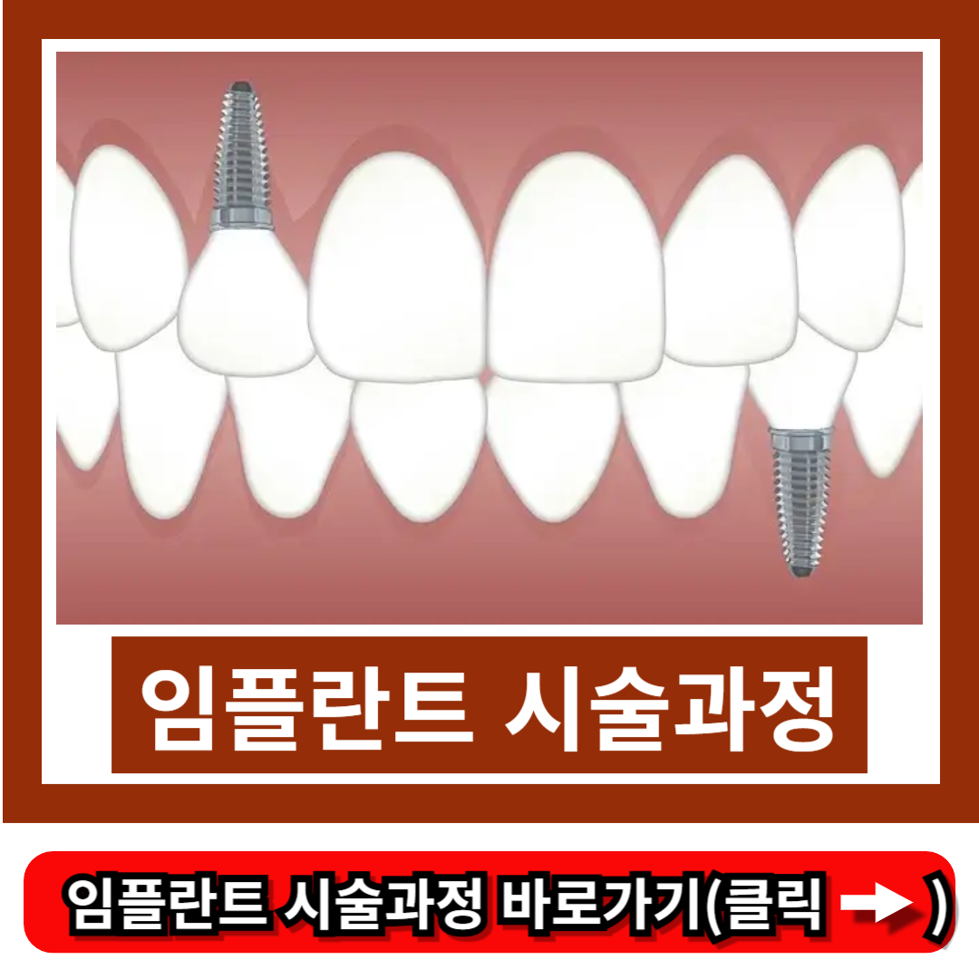 임플란트 시술과정