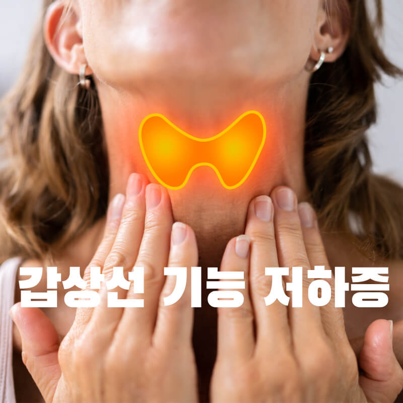 갑상선 기능 저하증