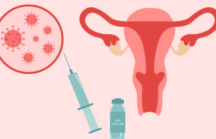 자궁근종 증상 7가지, 수술후 회복기간